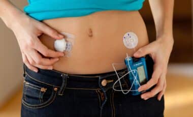 Artificial Pancreas For People With Type 1 Diabetes To Be Introduced In England