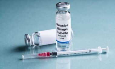 Measles outbreak